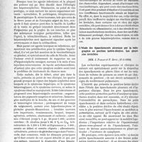 1055 - Page 1020 - Partie scientifique. L’actualité scientifique. Les Sociétés Savantes. Paris. Société médicale des hôpitaux de Paris. Hépatonéphrite suraiguë à la suite d’injection intra-veineuse du vaccin anti-chancrelleux, 13-1-1939} / L’étude des épanchements pleuraux par la radiographie en position latéro-déclive. Les pleurésies invisibles, (27-1-1939)