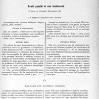 1236 - Page 1197 - Partie scientifique. Travaux originaux. La clinique ophtalmologique au gout du jour. L’oeil ypérité et son traitement, d’après le Docteur Bonnefon [G. Fischer]. Le tableau clinique des lésions / Les bases d’un traitement rationnel