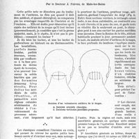 1283 - Page 1244 - Partie scientifique. Travaux originaux. Comment débrider l’anthrax de la nuque ?. Les incisions verticales parallèles, par le Docteur J. Fiévez