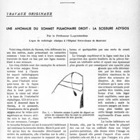2630 - Page 2563 - Partie scientifique. Travaux originaux. Une anomalie du sommet pulmonaire droit : la scissure azygos, par le Professeur Laquerrière, Leçon de radiologie clinique à l’Hôpital Notre-Dame de Montréal