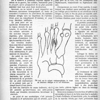 0377 - Page 370 - Partie scientifique. Le pied forcé, (Maladie du fantassin)