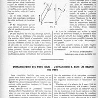0501 - Page 494 - Partie scientifique. Méthode radioscopique de localisation des projectiles / Sympathectomie des pieds gelés — l’avitaminose b. dans les gelures des pieds