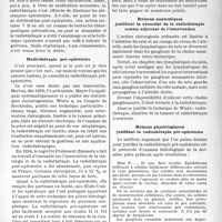 0732 - Page 725 - Partie scientifique. Travaux originaux. Le cancer du sein. Radiothérapie et chirurgie, par le Docteur Charles Guilbert
