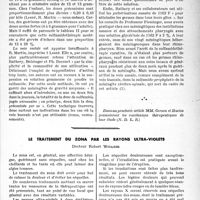 0020 - Page 17 - Travaux originaux. Les règles de la sulfamidothérapie de la méningite cérébro-spinale d'après l'étude de l’endémie méningococcique survenue en France durant l’hiver 1939-1940, Par MM. Charles Gernez et Claude Huriez / Le traitement du zona par les rayons ultra-violets, Docteur Robert Witasse