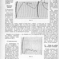 0257 - Page 254 - Étude des trompes sténosées par l’insufflation tubaire kymographique. Mesure du calibre de ces trompes et de celui des trompes normales, par Louis Bonnet. Étude des trompes sténosées / Étude du calibre des trompes normales