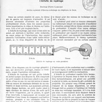 0318 - Page 315 - Travaux originaux. Un petit appareil destine à faciliter la recherche chirurgicale des corps étrangers profonds. L'échelle de repérage, Docteur Pierre Camuset