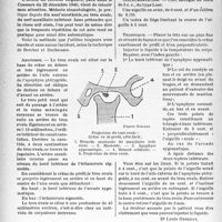 1045 - Page 1042 - Travaux originaux. Précisions sur la technique de repérage du trou ovale en vue de la neurolyse du nerf maxillaire inférieur