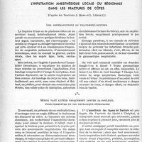 1377 - Page 1366 - La clinique chirurgicale au goût du jour. L'infiltration anesthésique locale ou régionale dans les fractures de côtes, d’après les Docteurs J. Hepp et L. Léger. Les contradictions du traitement-routine / Mieux vaut lutter uniquement contre la douleur, pour permettre un jeu thoracique nécessaire