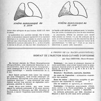 0171 - Page 146 - Partie scientifique. Un cas de pleurésie putride chez un grand alcoolique guérie par la pénicilline, Jacques Gaillard et Jean Gaillard. Interventions conservatrices / A propos de la rachi-anesthésie : Bienfait de l’injection sous-cutanée d’ortedrine, par Jean Cheynel