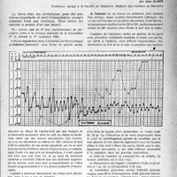 0530 - Page 505 - Partie scientifique. Clinique médicale. La fièvre chez les cirrhotiques, par Jean Olmer