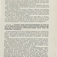 0127 - Page 125 - Sociétés savantes. Société française d'oto-rhino-laryngologie. Congrès tenu à Paris du 14 au 17 octobre 1925. Sargnon. - La radiumthérapie dans le traitement des tumeurs du naso-pharynx / Souchet. - Tumeur mixte dysembryolplastique du voile en voie de dégénérescence maligne traitée et guérie depuis vingt mois par le traitement radiumthérapique après échec du traitement chirurgical