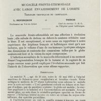 0167 - Page 165 - Faits cliniques. Mucocèle fronto-ethmoïdale avec large envahissement de l'orbite. Troubles trophiques du cristallin. L. Reverchon... et Tsiros...
