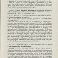 0181 - Page 179 - Sociétés savantes. Société bruxelloise d'oto-rhino-laryngologie. Année 1924. 28 mars 1924. Heyninx. - Impétigo de la lèvre supérieure avec cellulite streptococcique galopante labio-jugale sous-maxillaire et sublinguale droite / Paquay. - Kyste dermoïde de la région mastoïdienne / Paquay. - Carie aiguë du temporal / Hicguet. - Hémorragie de la veine mastoïdienne au cours d'une trépanation mastoïdienne