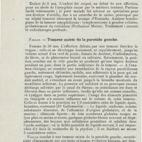0188 - Page 186 - Sociétés savantes. Société bruxelloise d'oto-rhino-laryngologie. Année 1924. 30 octobre 1924. Hicguet. - Fracture de l'os propre droit du nez / Van Swieten et Eeman. - Lymphosarcome de l'amygdale et de la voûte palatine droite / Fallas. - Tumeur mixte de la parotide gauche