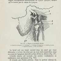 0526 - Page 524 - Mémoires. Microtie et dystrophie cranio-faciale. Par E. Leblanc... Recherche de l'oreille moyenne et de l'oreille interne