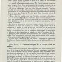 0619 - Page 617 - Sociétés savantes. Société de laryngologie des hôpitaux de Paris. Séance du 18 novembre 1925. André Bloch. - Lésion végétante du cavum associé à une adénite cervicale ; bacillose probable / André Bloch. - Tumeur bénigne de la langue chez un enfant