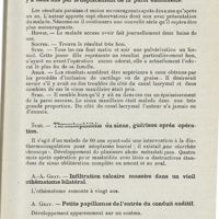 0822 - Page 821 - Sociétés savantes. Société écossaise de laryngologie et d'otologie. XXIIe Congrès, Glasgow, 21 novembre 1925. Donald Watson. - Technique pour la ligature des vaisseaux dans la loge amygdalienne / W. Syme. - Présentation de rhinites atrophiques opérées il y a deux ans par le déplacement de la paroi endonasale / Syme. - Thrombophlébite du sinus, guérison après opération / A.-A. Gray. - Infiltration calcaire massive dans un vieil othématome bilatéral / A. Gray. - Petits papillomes de l'entrée du conduit auditif / A. Brownkelly. - Sténose laryngée cicatricielle