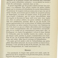 1203 - Page 1191 - Faits cliniques. Un cas mortel de pansinusite. Par J. van der Hoeven Léonhard... Observations / Résumé