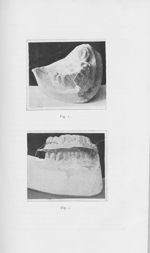 Fig. 1 / Fig. 2 - L'Odontologie