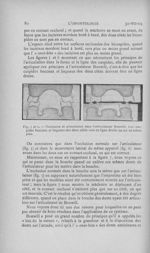 Fig. 5 et 6. — Occlusion et articulation dans l’articulateur Bonwill. Les cuspides buccaux et lingua [...]