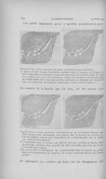 Figures 18 et 19 nous montrant la même articulation dans la bouche / figures 20 et 21 nous montrant  [...]