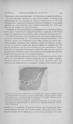 La figure 22 représente la différence de courbure de la ligne occlusale quand le condyloïd-path est  [...]