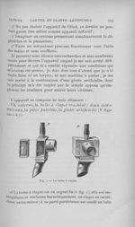 Fig. 1. — La boite à clapet - L'Odontologie