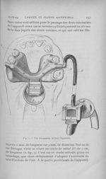 Fig. 2. — Vue d’ensemble de tout l’appareil - L'Odontologie