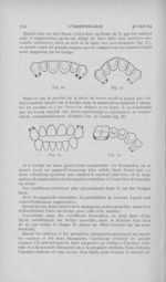 Fig. 26 à Fig. 29 - L'Odontologie