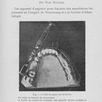 0465 - Page 463 - Travaux originaux. Présentations et démonstrations au congrès de Rouen (1921). Modification apportée à l’appareil d’urgence pour fracture du maxillaire par Paul Housset