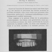 0118 - Page 112 - Travaux originaux. Redressement et immobilisation des dents dans un cas de pyorrhée alvéolaire par Eug. P. Darcissac