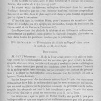 0900 - Page 757 - Réunions et congrès. Association française pour l'avancement des sciences. Congrès de la rochelle (23-29 juillet 1928). Séance du vendredi 27 juillet matin. H. De la Tour. - Contribution à l'étude de la radiographie maxillo-faciale / Mlle Guéricolas. - Présentation de clichés radiographiques selon la méthode de M. De la Tour