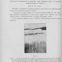 0097 - Page 96 - Revue des revues. Les tractus morts de la dentine par E. W. Fish