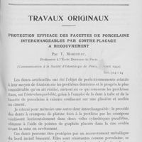 0161 - Page 153 - Travaux originaux. Protection efficace des facettes de porcelaine interchangeables par Contre placage à recouvrement par T. Morineau