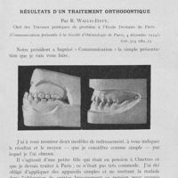0116 - Page 109 - Travaux originaux. Résultats d'un traitement orthodontique par R. Wallis-Davy