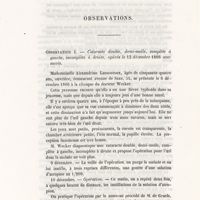 0043 - Page 43 - Observations. Observation I. Cataracte double demi-molle, complète à gauche, incomplète à droite, opérée le 12 décembre 1866 avec succès