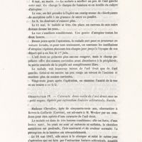 0047 - Page 47 - Observation IV. Cataracte demi-molle de l'oeil droit avec un petit noyau. Opérée par extraction linéaire scléroticale. Succès