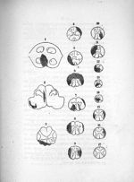 Etude anatomique et clinique de la sclérose en plaques