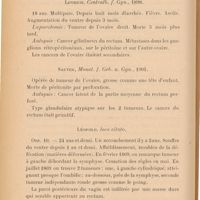 0152 - Page 150 - 6 - Cancer du rectum et tumeurs des ovaires