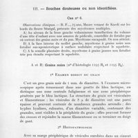 0519 - Page 466 - Séance du 8 juillet 1959. Mémoires. Identification des agents des maduromycoses du Sénégal et de la Mauritanie. Description d'une espèce nouvelle, par J. Baylet, R. Camain et G. Segretain. II. - Mycétomes à Leptosphaeria senegalensis n. sp. / III. - Souches douteuses ou non identifiées