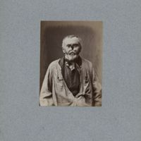0014 - Page sans numérotation - [Portraits d'homme avant et après pose de prothèse nasale]