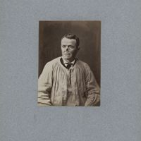 0016 - Page sans numérotation - [Portraits d'homme avant et après pose de prothèse nasale]