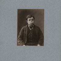 0018 - Page sans numérotation - [Portraits d'homme avant et après pose de prothèse nasale]
