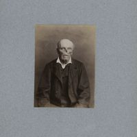 0024 - Page sans numérotation - [Portraits d'homme avant et après pose de prothèse nasale]