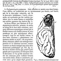 0701 - Page 697 - Dure-mère. Pathologie [E. Lancereaux] (bibliographie)