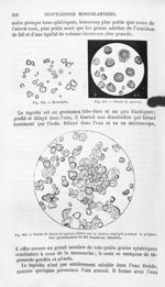 Moussache / Fécule de manioc / Grains de fécule de tapioca altérés par la chaleur employée pendant l [...]