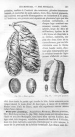 Pois à gratter / Petit pois pouilleux - Histoire naturelle des drogues simples, ou Cours d'histoire  [...]