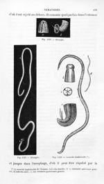Strongle / Ascaride lombricoïde - Histoire naturelle des drogues simples, ou Cours d'histoire nature [...]