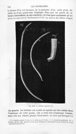 Trichina spiralis - Histoire naturelle des drogues simples, ou Cours d'histoire naturelle professé à [...]