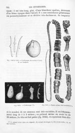 Cysticerque du cochon et trois de ses crochets / Cysticerque / Taenia solium (état strobilaire) - Hi [...]